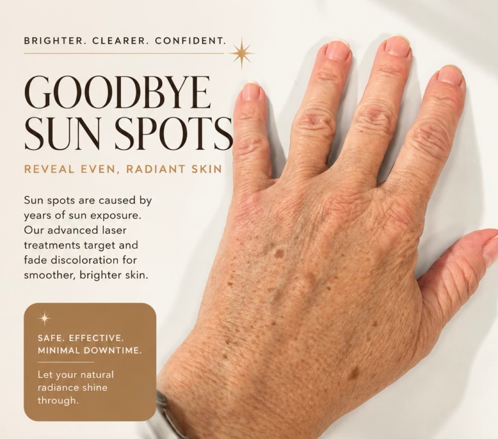 Sun Spot & Age Spot Removal — Salmon Arm Aesthetics, Salmon Arm BC