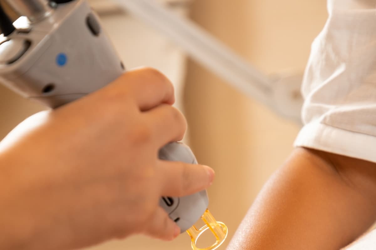 Q-Switched Nd:YAG Tattoo Removal