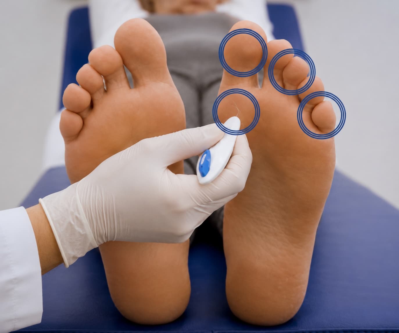 Diabetic Foot Care — Salmon Arm Aesthetics, Salmon Arm BC